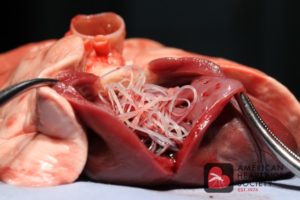 Here's what heartworms look like when dissected. 